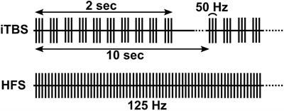 Frontiers | Subcortical Intermittent Theta-Burst Stimulation (iTBS ...